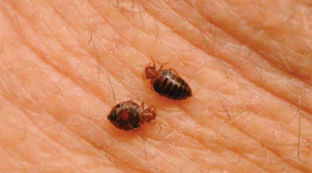 Closeup of bed bugs feeding on a person&apos;s skin.